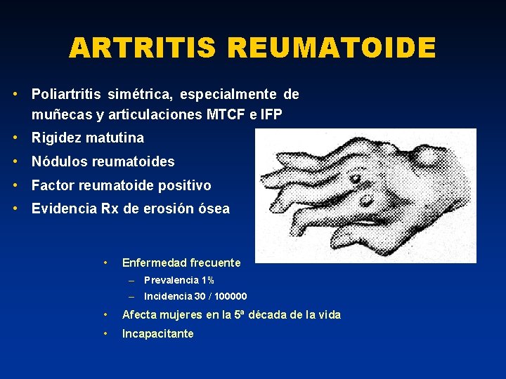 ARTRITIS REUMATOIDE • Poliartritis simétrica, especialmente de muñecas y articulaciones MTCF e IFP •