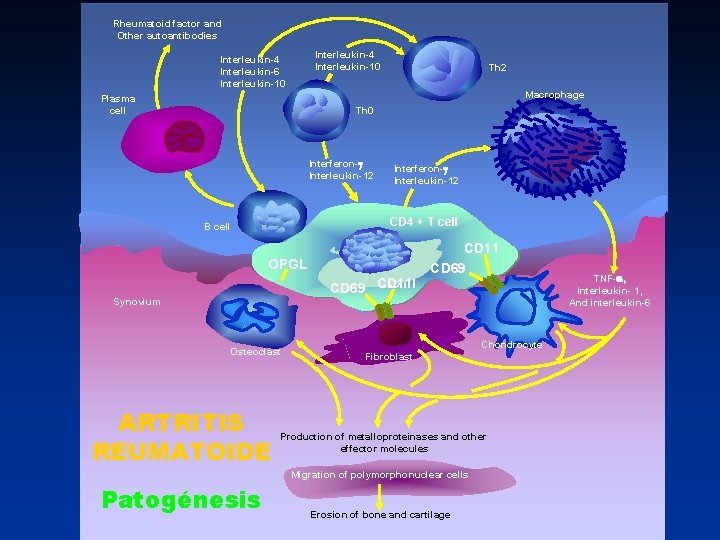 Rheumatoid factor and Other autoantibodies Interleukin-4 Interleukin-10 Interleukin-4 Interleukin-6 Interleukin-10 Th 2 Macrophage Plasma