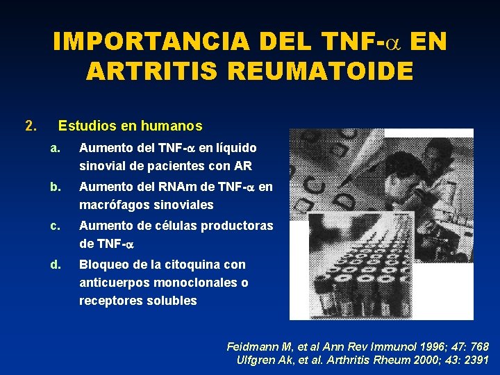 IMPORTANCIA DEL TNF- EN ARTRITIS REUMATOIDE 2. Estudios en humanos a. Aumento del TNF-