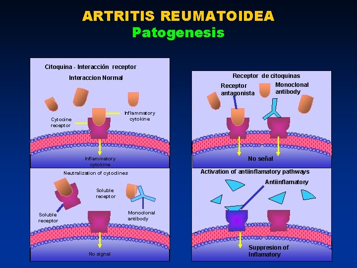 ARTRITIS REUMATOIDEA Patogenesis Citoquina - Interacción receptor Receptor de citoquinas Monoclonal Receptor antibody antagonista