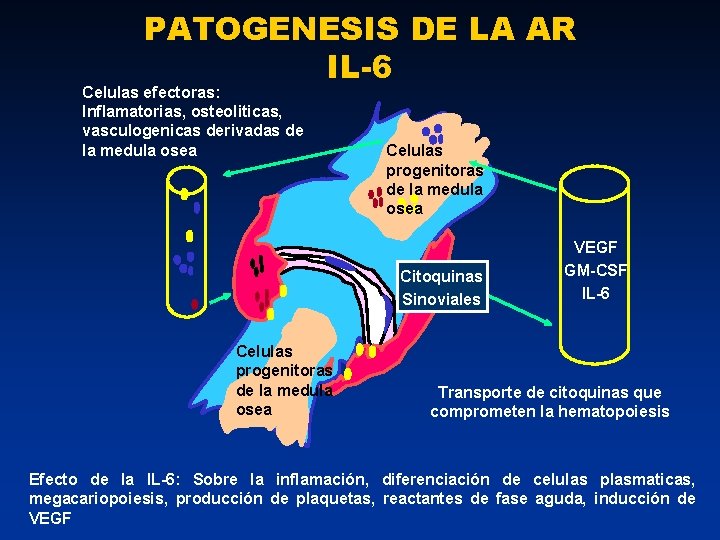 PATOGENESIS DE LA AR IL-6 Celulas efectoras: Inflamatorias, osteoliticas, vasculogenicas derivadas de la medula