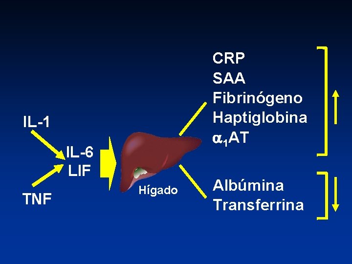 CRP SAA Fibrinógeno Haptiglobina 1 AT IL-1 IL-6 LIF TNF Hígado Albúmina Transferrina 