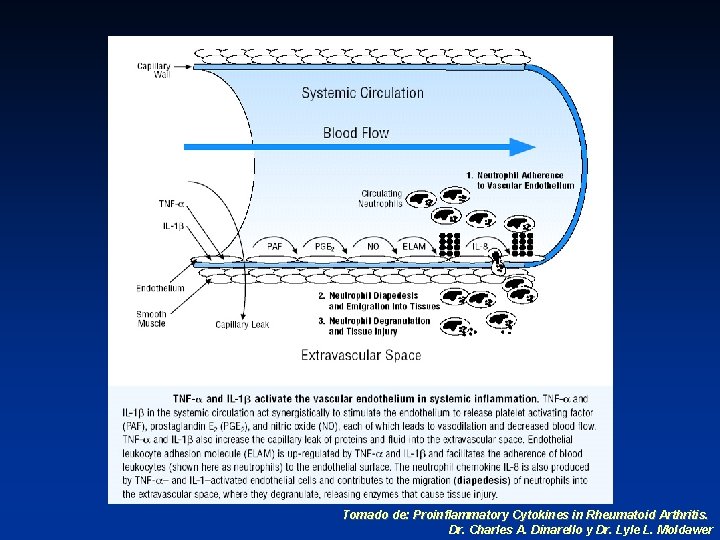Tomado de: Proinflammatory Cytokines in Rheumatoid Arthritis. Dr. Charles A. Dinarello y Dr. Lyle
