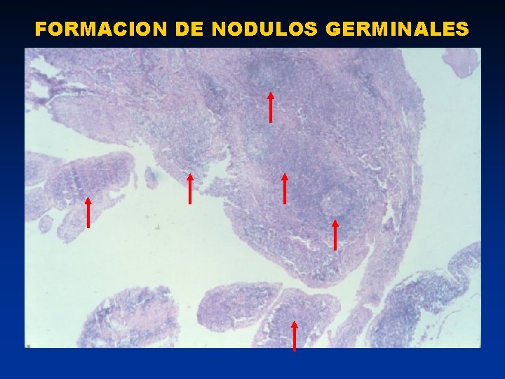 FORMACION DE NODULOS GERMINALES 