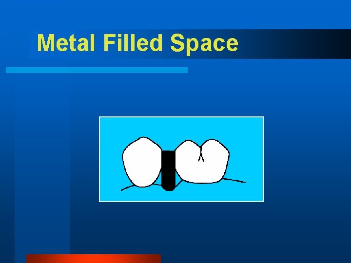 Metal Filled Space 