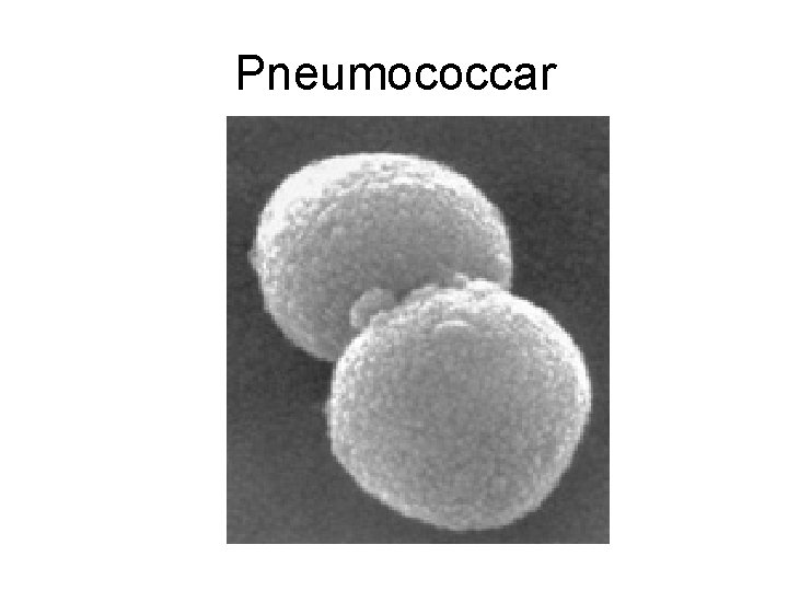Pneumococcar 