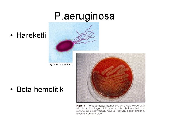 P. aeruginosa • Hareketli • Beta hemolitik 