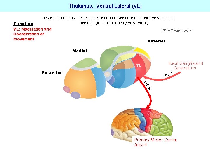 Thalamus: Ventral Lateral (VL) Thalamic LESION: In VL interruption of basal ganglia input may