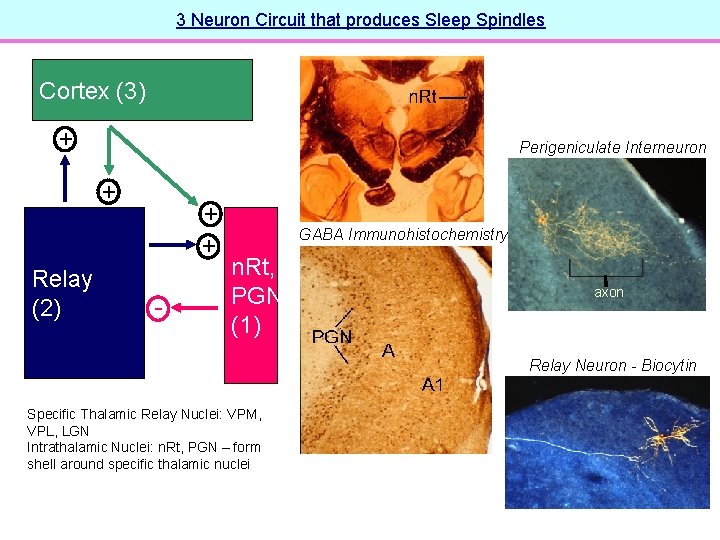 3 Neuron Circuit that produces Sleep Spindles Cortex (3) + Perigeniculate Interneuron + Relay