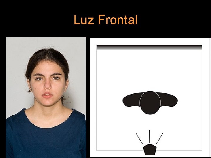 Luz Frontal 