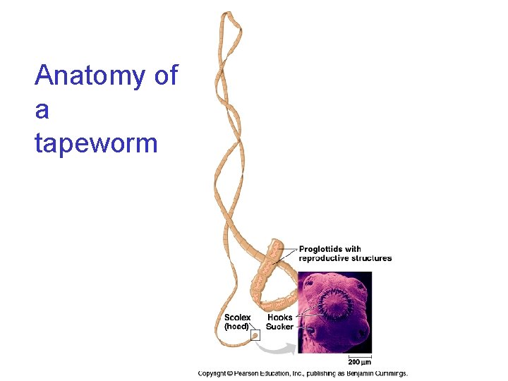 Anatomy of a tapeworm 