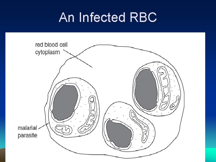 An Infected RBC 