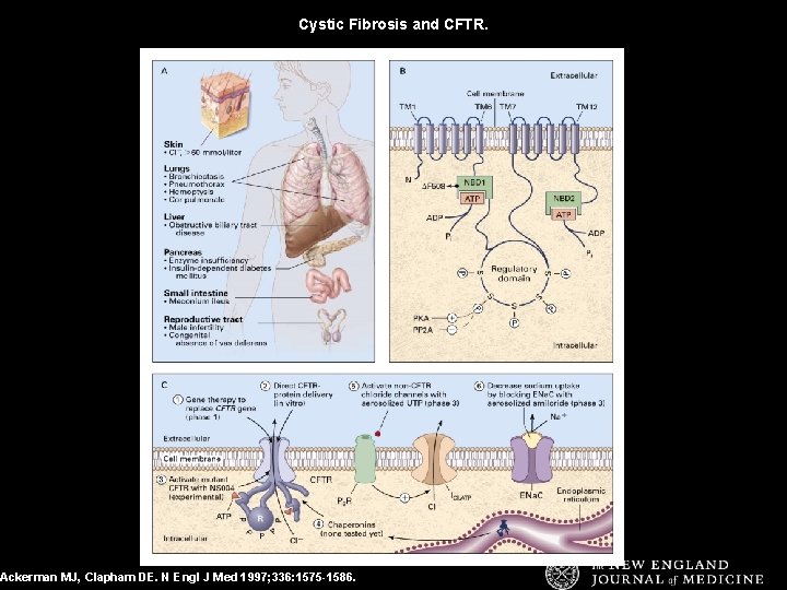 Cystic Fibrosis and CFTR. Ackerman MJ, Clapham DE. N Engl J Med 1997; 336: