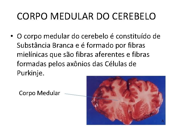 CORPO MEDULAR DO CEREBELO • O corpo medular do cerebelo é constituído de Substância