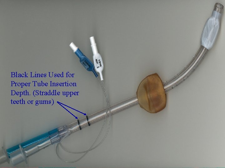 Black Lines Used for Proper Tube Insertion Depth. (Straddle upper teeth or gums) 