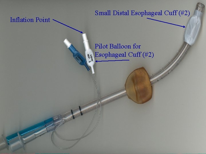 Inflation Point Small Distal Esophageal Cuff (#2) Pilot Balloon for Esophageal Cuff (#2) 