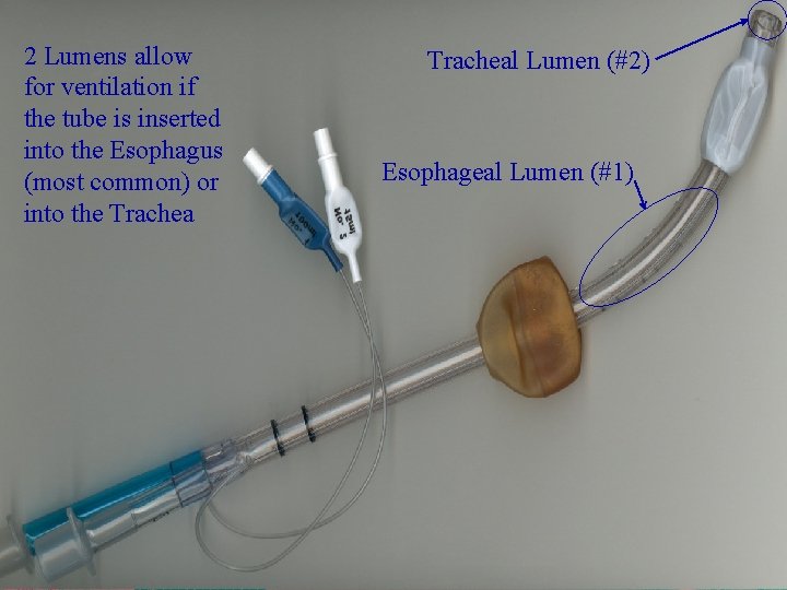 2 Lumens allow for ventilation if the tube is inserted into the Esophagus (most