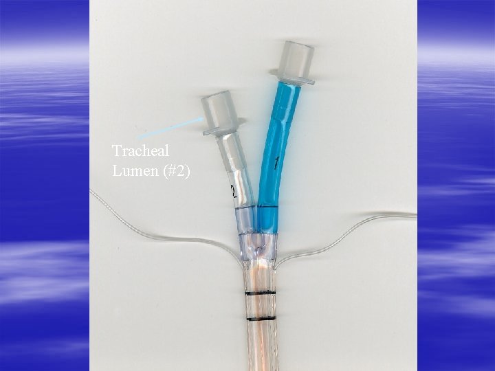 Tracheal Lumen (#2) 