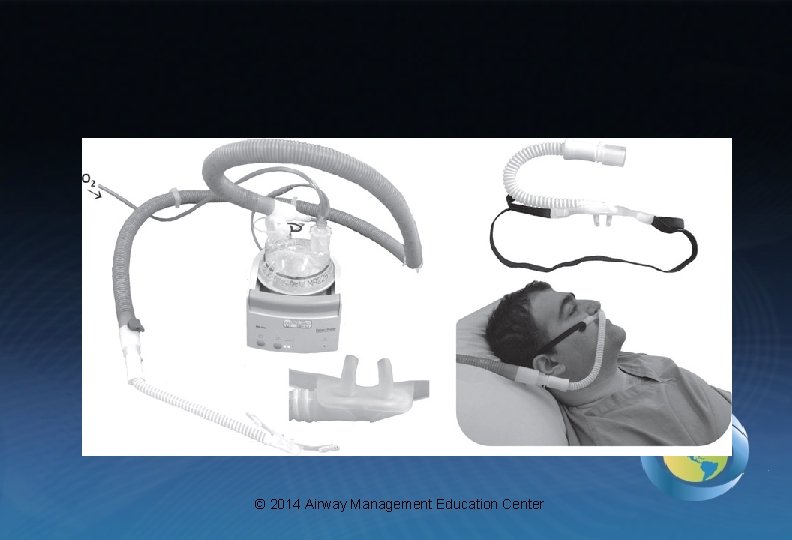 © 2014 Airway Management Education Center 