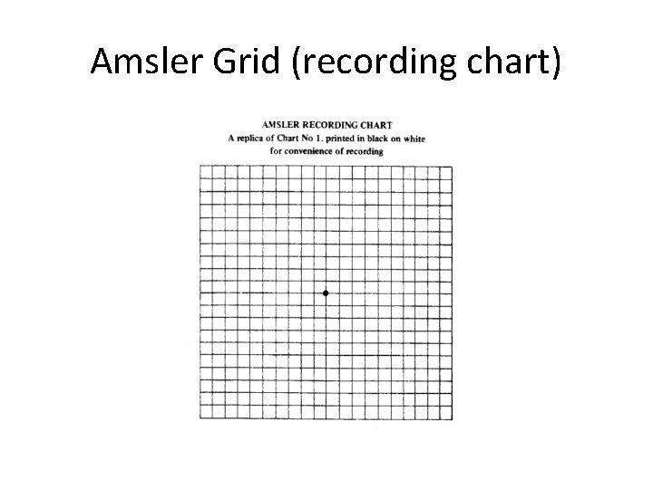 Amsler Grid (recording chart) 