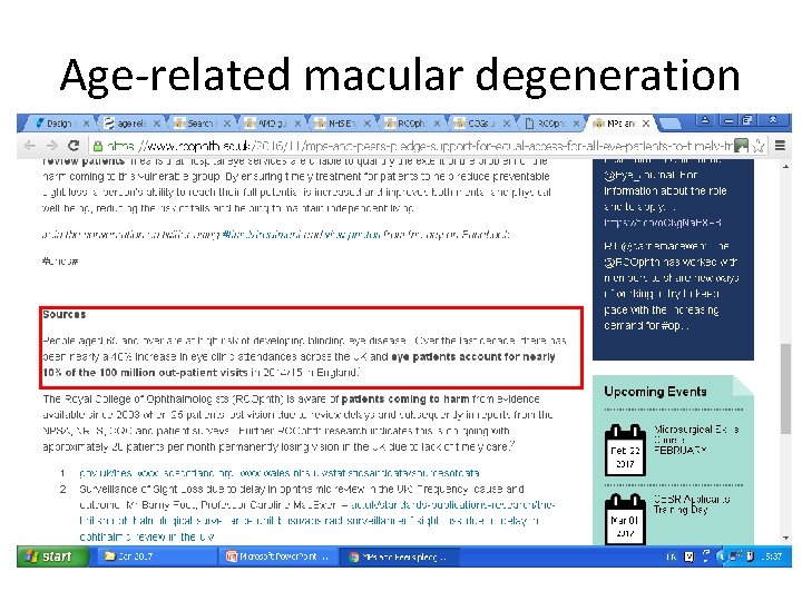 Age-related macular degeneration 