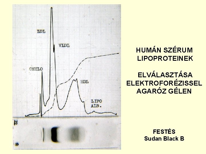 HUMÁN SZÉRUM LIPOPROTEINEK ELVÁLASZTÁSA ELEKTROFORÉZISSEL AGARÓZ GÉLEN FESTÉS Sudan Black B 