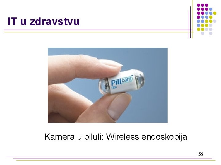 IT u zdravstvu Kamera u piluli: Wireless endoskopija 59 