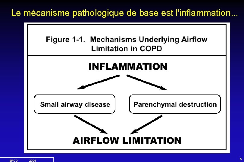 Le mécanisme pathologique de base est l'inflammation. . . BPCO 2004 6 