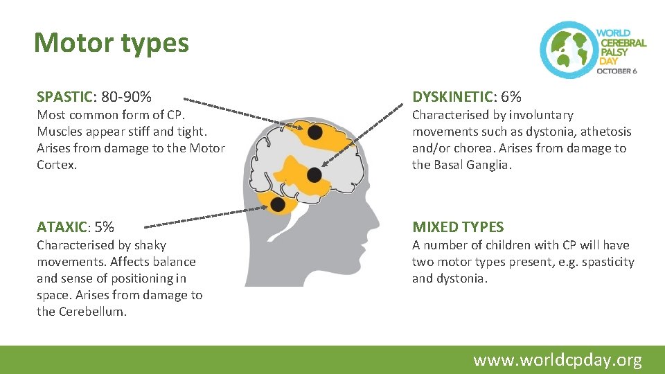 Motor types SPASTIC: 80 -90% DYSKINETIC: 6% ATAXIC: 5% MIXED TYPES Most common form