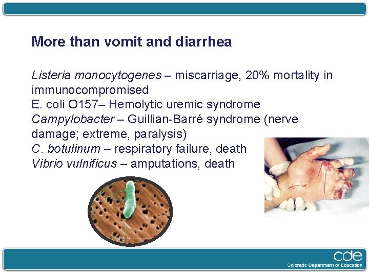 More than vomit and diarrhea Listeria monocytogenes – miscarriage, 20% mortality in immunocompromised E.