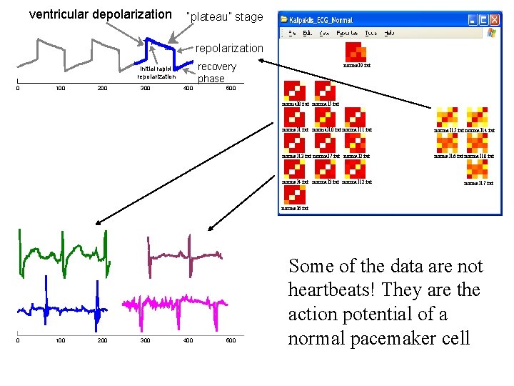 ventricular depolarization “plateau” stage repolarization recovery phase initial rapid repolarization 0 100 200 300