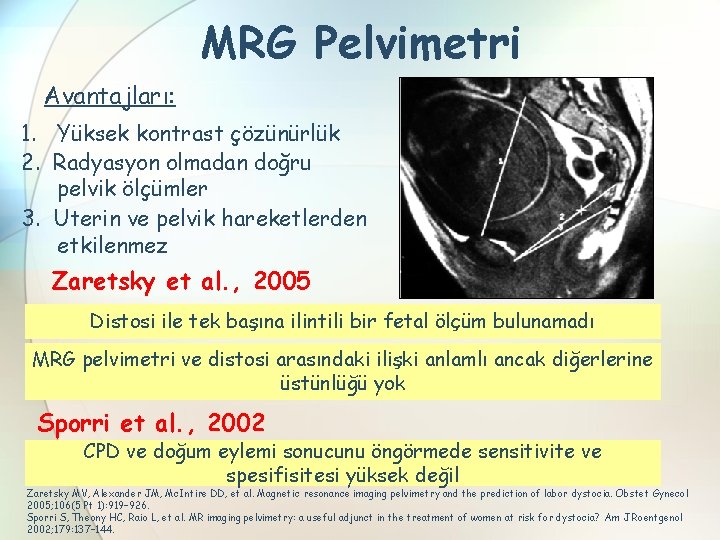 MRG Pelvimetri Avantajları: 1. Yüksek kontrast çözünürlük 2. Radyasyon olmadan doğru pelvik ölçümler 3.