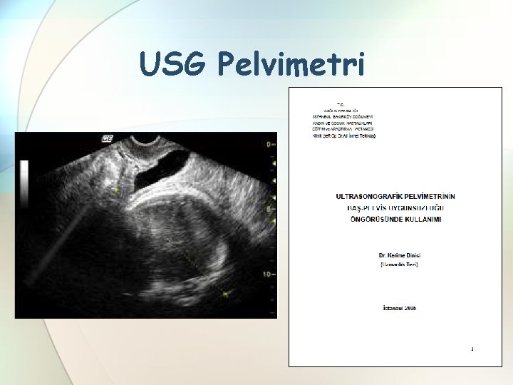 USG Pelvimetri 