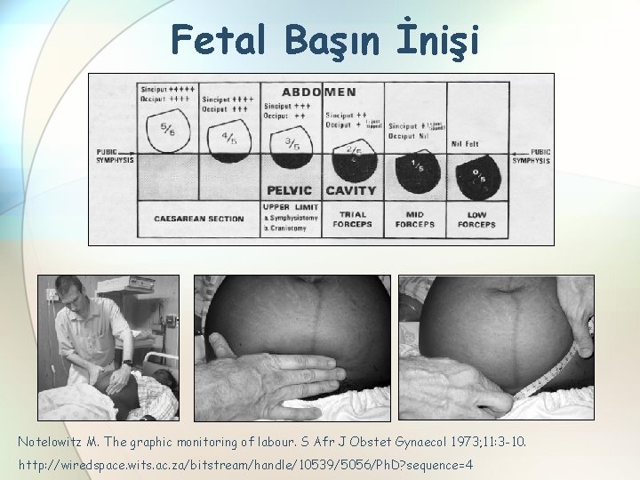 Fetal Başın İnişi Notelowitz M. The graphic monitoring of labour. S Afr J Obstet