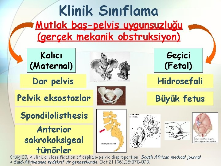 Klinik Sınıflama Mutlak baş-pelvis uygunsuzluğu (gerçek mekanik obstruksiyon) Kalıcı (Maternal) Geçici (Fetal) Dar pelvis