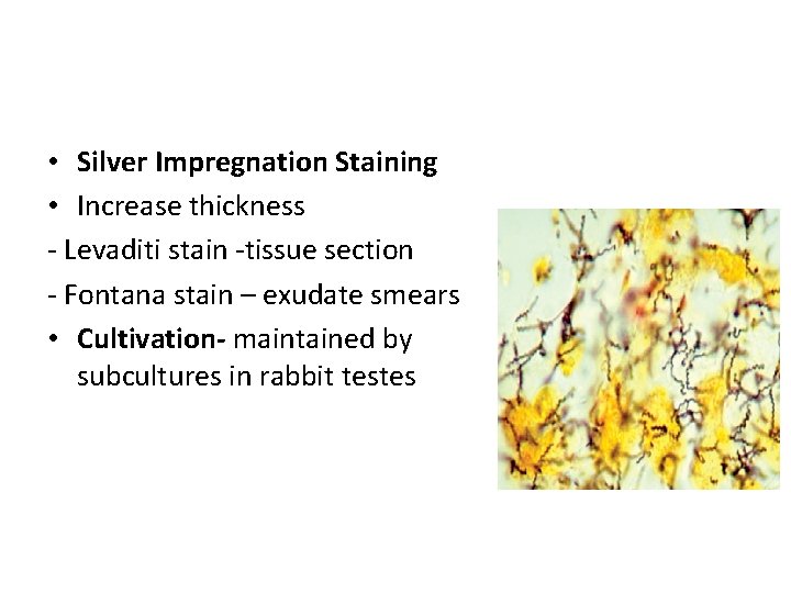 LABORATORY DIAGNOSIS OF SYPHILIS • Silver Impregnation Staining • Increase thickness - Levaditi stain