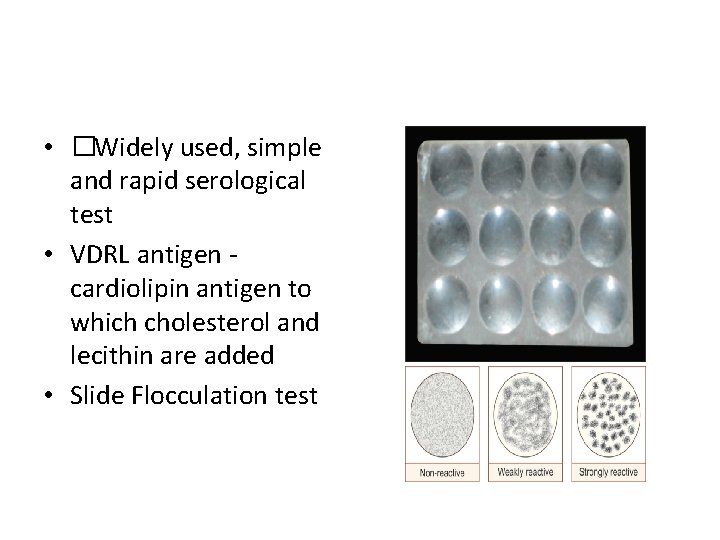 Venereal Disease Research Laboratory (VDRL) • �Widely used, simple and rapid serological test • Venereal Disease Research Laboratory (VDRL) • �Widely used, simple and rapid serological test •