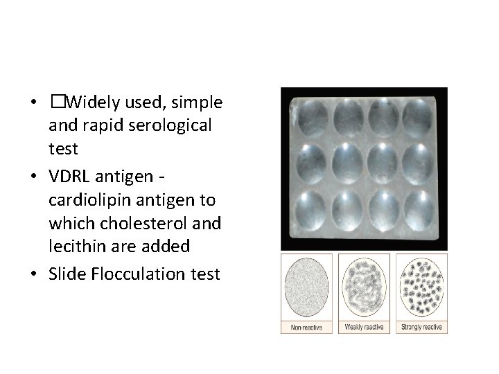 Venereal Disease Research Laboratory (VDRL) • �Widely used, simple and rapid serological test •