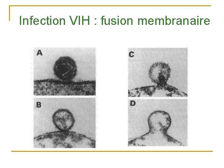 Infection VIH : fusion membranaire 