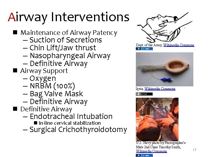 Airway Interventions n Maintenance of Airway Patency – Suction of Secretions – Chin Lift/Jaw