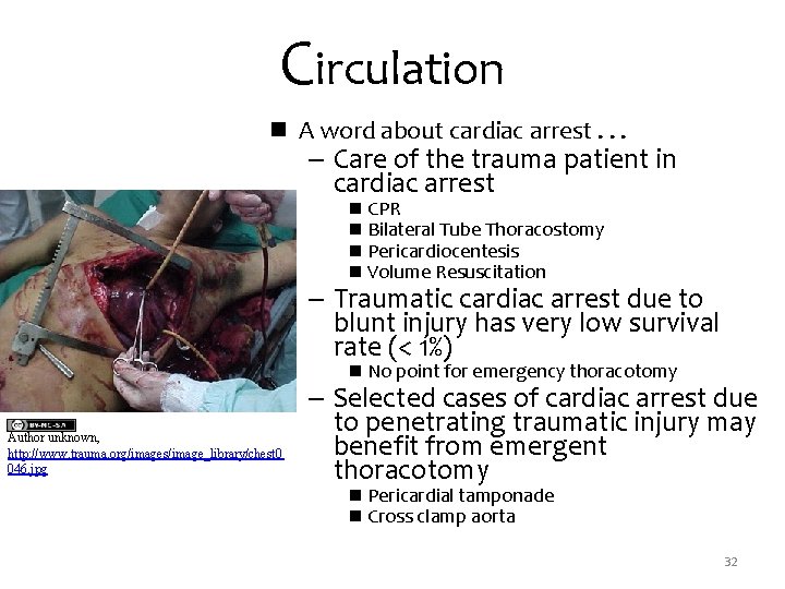 Circulation n A word about cardiac arrest. . . – Care of the trauma