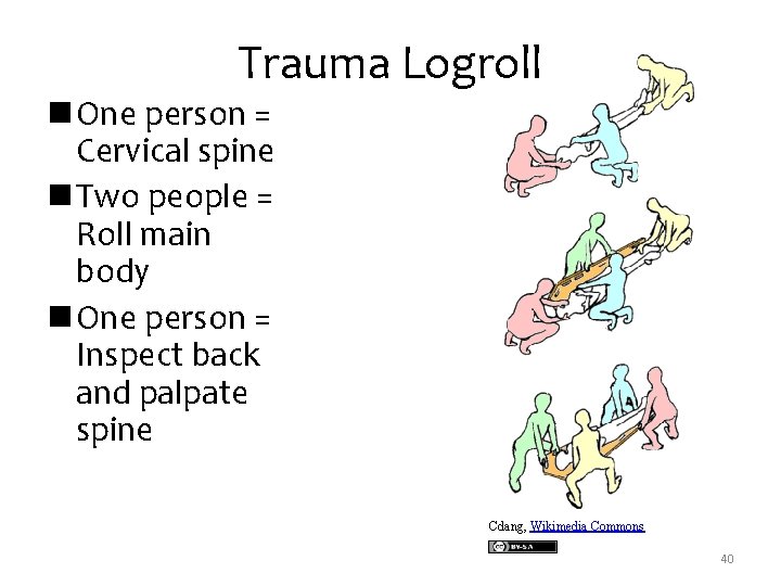Trauma Logroll n One person = Cervical spine n Two people = Roll main