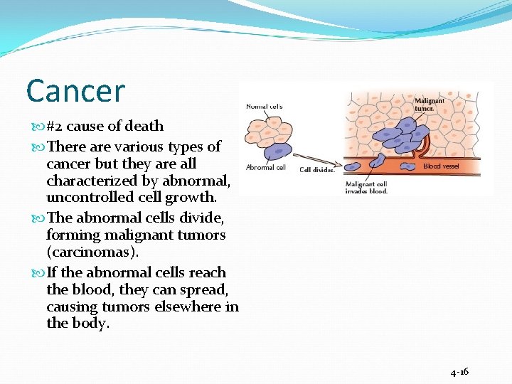 Cancer #2 cause of death There are various types of cancer but they are