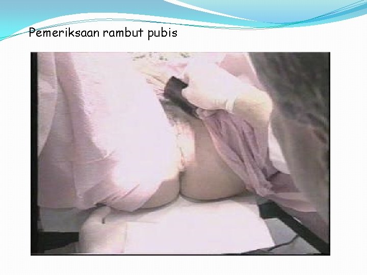 Pemeriksaan rambut pubis 