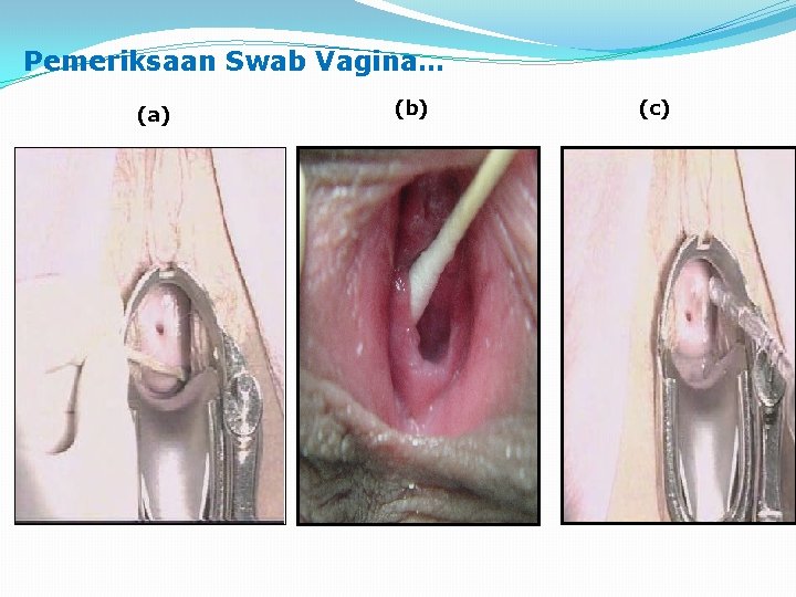 Pemeriksaan Swab Vagina… (a) (b) (c) 