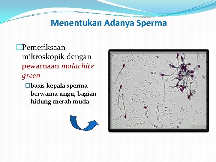 Menentukan Adanya Sperma �Pemeriksaan mikroskopik dengan pewarnaan malachite green �basis kepala sperma berwarna ungu,