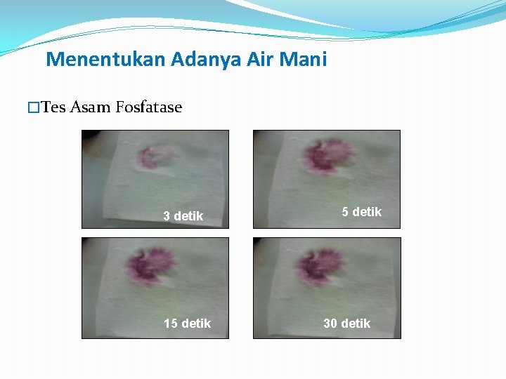 Menentukan Adanya Air Mani �Tes Asam Fosfatase 3 detik 15 detik 30 detik 