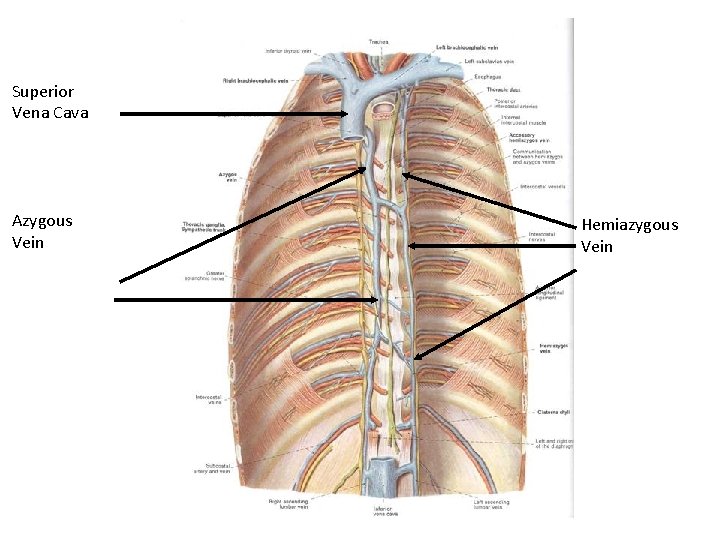 Superior Vena Cava Azygous Vein Hemiazygous Vein Superior Vena Cava Azygous Vein Hemiazygous Vein