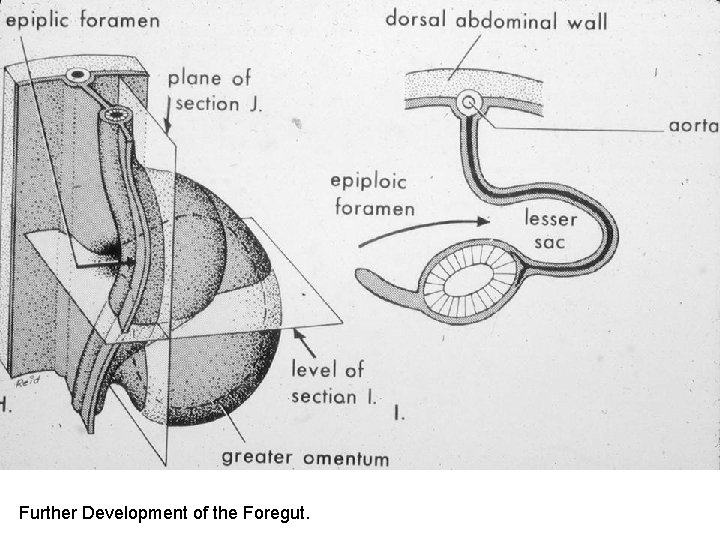 Continued Development of the Stomach Further Development of the Foregut. Continued Development of the Stomach Further Development of the Foregut.
