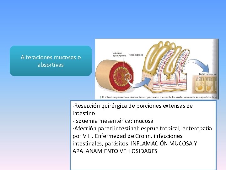Alteraciones mucosas o absortivas -Resección quirúrgica de porciones extensas de intestino -Isquemia mesentérica: mucosa